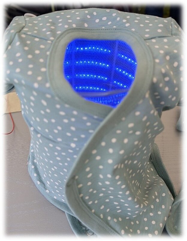Abb.2: Im Rahmen des Projektes hergestellter Demonstrator: Ein Baby-Body mit integriertem Polymer-Elektronikverbund zur Therapierung von Neugeborenengelbsucht.