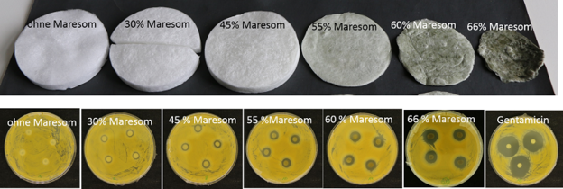 Abb. 3: Kollagenschwämme mit unterschiedlichen Gehalten an Maresomen (oben) Hemmhöfe der Kollagenschwämme mit unterschiedlichen Gehalten an Mareso men nach Agardiffusionstest Stapphylococcus aureus ATC 6538 nach DIN 58940 (unten)